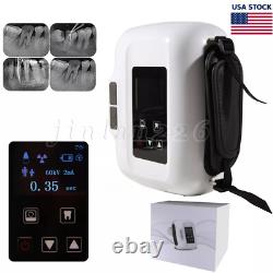 Máquina Rayos Digital Dental Portátil Rayos Portatil Machine Rx Unidad Ray